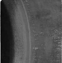 04 usure anormale unilat&eacute;rale